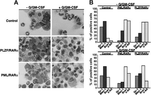 Figure 1. Block of myeloid differentiation induced by X-RARα. Sca1+/lin- HSCs were transduced with PML/RARα or PLZF/RARα. Mock-transduced cells were used as control. The cells were seeded in semisolid medium ± G/GM-CSF for the induction of granulocytic/monocytic differentiation. At day 10 the cells were harvested and analyzed. (A) Morphologic analysis of cells stained with May-Grünwald-Giemsa. Original magnification, × 400. (B) Differentiation-specific surface marker expression. Gr-1 and Mac-1 are markers for myeloid differentiation and Sca1 and c-kit are stem cell markers. One representative experiment of 3 is given.