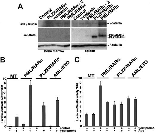 Figure 3. Induction of γ-catenin by X-RARα (A) Sca1+/lin- stem cells transduced with PML/RARα, PLZF/RARα, or γ-catenin were transplanted into sublethally irradiated recipient mice. At day 10 after transplantation MNCs from the BM and the spleen were analyzed by Western blotting for the expression of X-RARα and γ-catenin. Another PML/RARα-positive animal that showed disease symptoms at day 12 after transplantation (PML/RARα-2) was included. The blots were first incubated with an anti-RARα antibody and after stripping with an anti-γ-catenin antibody. Equal protein loading was confirmed after further stripping of the membrane and staining with an anti-β-tubulin antibody. The corresponding bands are indicated. (B) Transactivation of the γ-catenin promoter by X-RARα and AML-1/ETO. The γ-catenin promoter construct was transfected by electroporation into U937 cells expressing the respective transgenes under the control of an Zn2+-inducible methallothionein 1 (MT-1) promoter. The pGL3basic was used as control. Twelve hours after transfection the transgene expression was induced by the exposure to 100 μM Zn2SO4, and luciferase expression was measured 24 hours later and normalized with Renilla activity. The average of triplicates of one representative of 3 independent experiments is given. (C) Effect of t-RA on the transactivation of the γ-catenin promoter by X-RARα and AML-1/ETO. Twelve hours after transfection the transgene expression was induced by the exposure to 100 μM Zn2SO4 for 4 hours prior to adding t-RA at a concentration of 10-6 M, and luciferase expression was measured 24 hours later. The average of triplicates of one representative of 3 independent experiments is given.