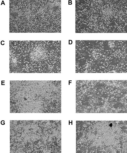 Figure 1. Photomicrographs of wild-type and IL-6-/- LTBMCs. Cultures were established from wild-type (A, C, E, G) or IL-6-/- (B, D, F, H) BM and were maintained in Myelocult M5300 medium containing 10-6 M hydrocortisone at 32°C, with weekly exchange of half of the medium. Photomicrographs were obtained 1 (A-B), 2 (C-D), 3 (E-F), or 4 (G-H) weeks after initiation of cultures. Original magnification × 100.
