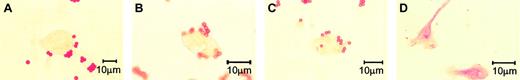 Figure 1. AC-133 immunocytochemistry of circulating endothelial cells. Note that circulating endothelial cells from a patient after allogeneic hematopoietic stem cell transplantation were AC-133 negative (A-C), whereas human endothelial progenitor cells served as positive controls (panel D; donated by Dr F.H. Bahlmann); we used murine anti-human AC-133 antibody (Miltenyi), and APAAP technique (Dako).
