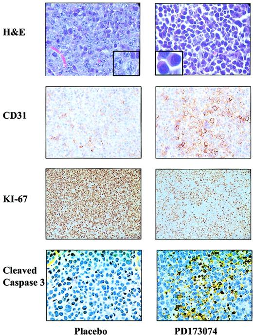 Figure 6. Inactivation of FGFR3 induces differentiation of KMS11 cells in vivo.KMS11-derived tumors from placebo- and PD173074-treated mice analyzed by hematoxylin and eosin (H&E) staining and immunostaining for CD31, Ki-67, and cleaved caspase 3. No effect of PD17074 treatment was noted in 8226 tumors similarly treated (data not shown). Original magnification, × 400.
