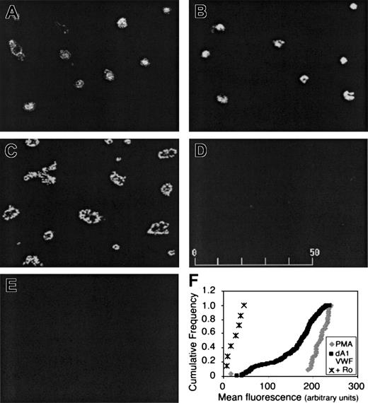 Figure 4. Platelet adhesion to dA1VWF causes αIIbβ3 activation. Cells were plated over coverslips coated with dA1VWF (A-D) or BSA (E) for 40 minutes in the presence of PAC-1. Platelets were then fixed and stained with an FITC-conjugated antibody against PAC-1 and imaged by confocal microscopy. (A) Platelets adherent to dA1VWF in the presence of inhibitors of signaling through ADP and thromboxane A2 receptors. (B) Same as panel A but no such inhibitors. (C) Platelet adhesion to dA1VWF in the presence of 200 nM PMA to activate PKC. (D) Platelet adhesion to dA1VWF in the presence of αIIbβ3 antagonist, Ro 44-9883 (Ro; 10 μM). (F) Heterogeneity of αIIbβ3 activation in the platelet population under conditions in which signaling through ADP and thromboxane A2 receptors was inhibited. Depicted is the cumulative frequency distribution of fluorescence values within the platelet population.