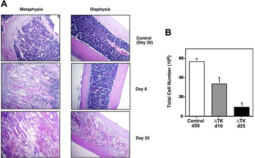 Figure 1. Depletion of osteoblasts affects cellularity in the bone marrow. (A) Control wild-type littermates and Col2.3ΔTK mice were injected with GCV; at defined times they were killed, and their bones were subjected to histologic analysis. Tissue was placed in paraffin and stained with hematoxylin and eosin. Microphotographs were taken at 10 × magnification. (B) Absolute number of cells recovered from bone marrow of 4 long bones in control and Col2.3ΔTK mice after GCV treatment.