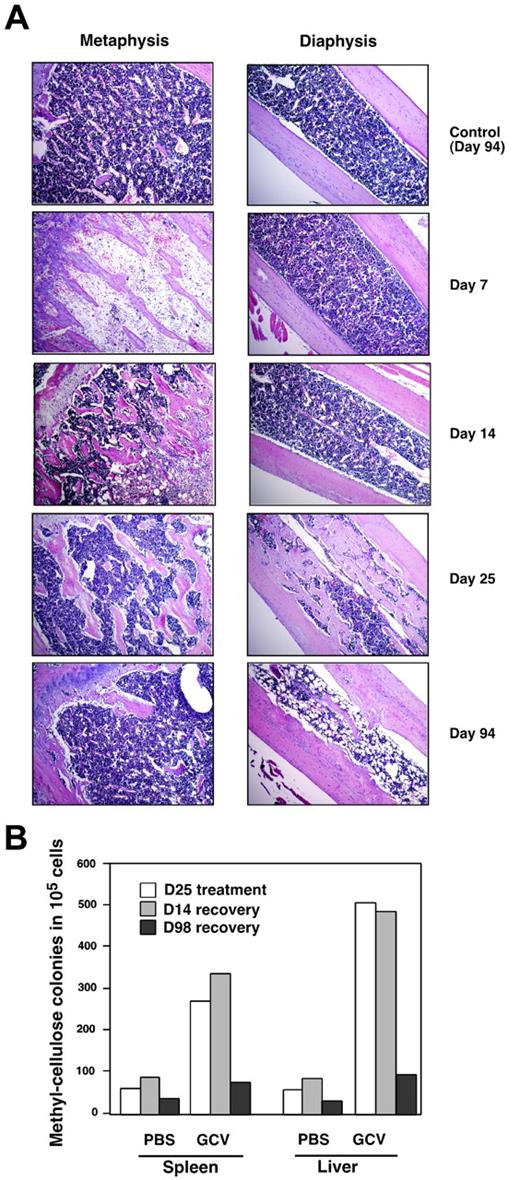Figure 7. Analysis of bone marrow cellularity and extramedullary hematopoiesis after GCV withdrawal. (A) Col2.3ΔTK mice were treated with PBS or GCV for 45 days, after which the treatment was stopped. At different days after the withdrawal of treatment, animals were killed and their bones were evaluated histologically for their ability to reconstitute bone marrow cellularity. Paraffin section were stained with hematoxylin and eosin, and microphotographs were taken at an original magnification of 10 ×. (B) Animals were treated with ganciclovir or PBS as described. Spleen and liver suspensions were evaluated by their ability to generate myeloerythroid colonies in methylcellulose at different time points after withdrawal of treatment.