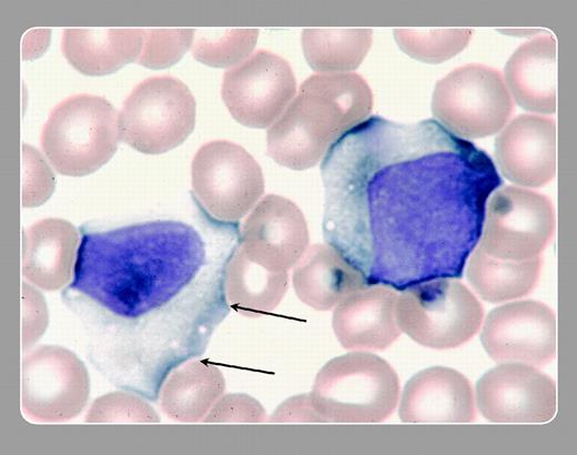 Peter Maslak and Susan McKenzie, Memorial Sloan-Kettering Cancer Center