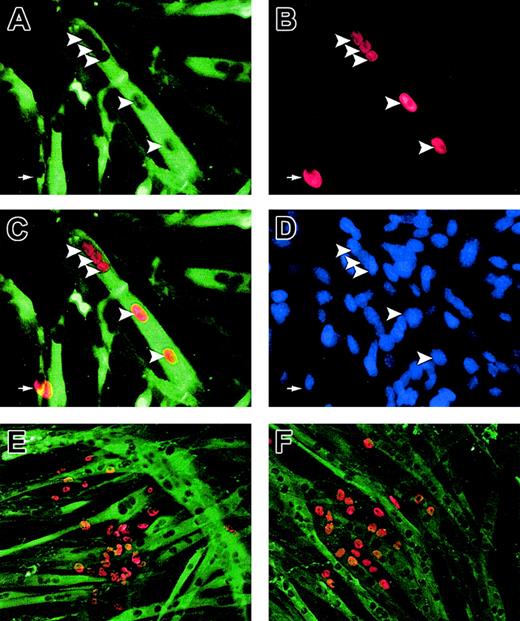 Figure 1. Triple staining to identify cell fusion. Human marrow cells (5000) from a long-term culture were cocultured with C2C12 cells (5000) for 4 days under conditions that favored proliferation. The cultures were then switched to differentiation media for 2 days to induce myogenic fusion. Myotubes were revealed by sarcomeric myosin heavy chain monoclonal antibody MF20 (A). Human nuclei were detected by antibody specific to human nuclei (B). The fusion of human marrow cells (arrowhead) with myotubes was detected by correlating the human nuclei with nuclear spaces in the myotube (C). In contrast, unfused stromal cells (arrow) did not align with the myotube nuclear space. Total cell nuclei in the culture were stained with DAPI (D, blue). The same results were observed from CD45-depleted primary stromal cells and mesenchymal stem cells. However, human stromal cell lines HS-5 (E) and HS-27a (F) failed to fuse with C2C12 in coculture. Original magnifications: × 200 (A-D) and × 100 (E-F).
