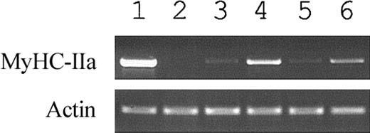 Figure 2. Fusion induces human myosin heavy chain expression. RT-PCR of the cultured cells shows elevated expressions of human skeletal myosin heavy chain IIa (MyH-2a) in cocultures of stromal cells and C2C12 cells. Lane 1 is from human skeletal muscle cells and serves as a positive control; lane 2, C2C12 cells alone; lane 3, human MSCs alone; lane 4, coculture of MSCs and C2C12; lane 5, human LTCs alone; and lane 6, coculture of human LTCs and C2C12. Actin was used as a loading control.