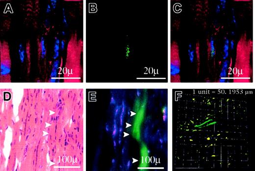 Figure 3. Fusion of human MSCs in regenerating mouse TA muscle. The TA muscle of the NOD/SCID β2m–/– mouse was damaged by cardiotoxin injection followed 24 hours later by injection of MSCs. The regenerating TA muscles were evaluated 7 days later. Immunoflorescence staining of regenerating TA muscle showed the presence of human nuclei in muscle fibers. (A) Red rhodamine-phalloidin staining of mouse TA muscle with blue DAPI nuclear staining. (B) Human nuclear staining (green) with antihuman nuclear antibody. (C) Composite of A and B. (D) H&E staining of a frozen section of regenerating TA muscle. (E) Fluorescence microscopy of the same section showing a GFP-expressing fiber. (F) Two GFP-positive fibers, each longer than 100 μm, are shown in a snapshot of a 3-dimensional projection of a stack of 44 green and red 2-channel images of a regenerating TA muscle. See Supplemental Video S1 for a rotating video of this section. Panels A-C imaged by Deltavision UApo 340; × 40/1.35; D-E, Nikon Plan Apo × 10/0.45; and F, Confocal Plan Apo × 20.0/0.70.