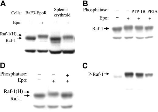 Figure 1. Raf-1 undergoes a mobility shift in response to EPO, which can be reversed by phosphatase treatment. (A) BaF3-EpoR cells or normal murine splenic erythroid cells were treated with EPO for 5 minutes, and cytoplasmic extracts were subjected to Western blotting with anti–Raf-1 antibody. Note mobility shift (hypershift) Raf-1(H). (B) BaF3-EpoR cell cytoplasmic extract was incubated with phosphatase PTP-1B or PP2A for 20 minutes at 30° C, followed by Western blotting with anti–Raf-1 antibody. (C) The membrane shown in panel B was stripped and reprobed with anti–Raf-1 phosphoserine 338 antibody. (D) Cytoplasmic extract was incubated with a combination of phosphatases PTP-1B and PP2A for 20 minutes at 30° C, followed by Western blotting with anti–Raf-1 antibody.