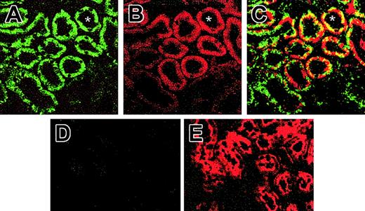 Figure 3. Immunofluorescence for SOD3 and EPO protein in kidneys of animals exposed to hypoxia for 6 hours. (A) Confocal laser scanning micrograph of histologic sections of Wt kidney stained with antibody against SOD3. Renal sections were visualized with FITC-conjugated secondary antibody. SOD3 stained as brilliant green immunofluorescence in the proximal tubules; faint labeling is seen in the glomeruli and other tubules. (B) Confocal micrograph of Wt kidney stained for EPO using Cy3 secondary antibody. EPO stained as brilliant red fluorescence in the proximal tubules of the cortex. No staining was observed in glomeruli, distal tubule cells, or medulla. (C) Dual-labeling immunofluorescence of SOD3 with FITC (green) colocalizing with EPO Cy3 (red). Overlay of images in panels A and B reveals colocalization of SOD3 and EPO proximal tubule (yellow fluorescence). (D) KO kidney shows negligible SOD3 expression. (E) KO kidney shows EPO expression. Asterisk (*) denotes proximal tubules (original magnification, × 650).
