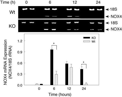 Figure 6. Renal NOX4 mRNA expression after hypoxia. Gel Star–stained 2% agarose gels demonstrating NOX4 transcripts coamplified with 18S rRNA to control for RNA loading and efficiency of RT-PCR (top panel). Bottom panel shows quantitative NOX4 gene expression after normalization to 18S rRNA. Densitometry values are mean ± SEM (n = 6 mice per group; *P < .05).
