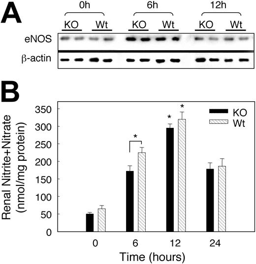 Figure 7. Effect of hypoxia on renal eNOS expression and plasma NOx. (A) Representative Western blots showing eNOS antibody detected a single band at the expected 140 kDa; hypoxia increased eNOS staining intensity in both strains of mice. β-actin was used for normalization and verification of protein loading. (B) Changes in plasma nitrite/nitrate after hypoxia. A significant increase in NOx was detected after 6 hours of hypoxia in Wt mice and in both strains after 12 hours. Values are means ± SEM.