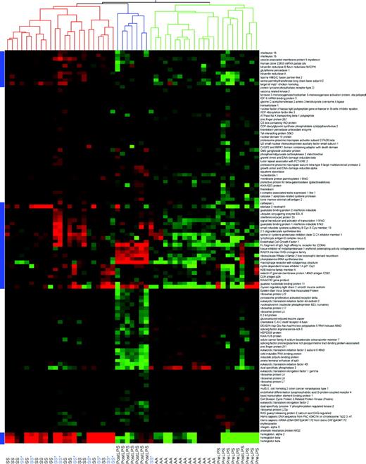Figure 6. Comparison of gene expression patterns of sickle cell disease to those of a general inflammatory state. Genes were selected based on the comparison of mean gene expression levels between sickle cell disease patients and African-American healthy volunteers using a 1.2 fold-change cut off, an average difference more than 20 filter in either sickle cell disease or control group and a less than or equal to 5% false discovery rate multiple comparisons correction. Cluster analysis was applied to gene expression data from sickle cell disease patients of HbSS phenotype on (SS*) or off (SS) hydroxyurea therapy, African-American healthy volunteers (AA), a separate set of healthy volunteers (Pre LPS), and these same volunteers following intravenous endotoxin infusion (Post LPS). This figure shows that there are similarities in gene expression patterns for these 112 genes between sickle cell disease and an inflammatory state induced by endotoxin infusion. Importantly, there are clusters of genes, marked by the blue bars to the left of the figure, that show differential expression between sickle cell disease and endotoxin infusion, suggesting that the gene expression changes observed in sickle cell disease are not due solely to a generalized inflammatory state but are specific for sickle cell disease.