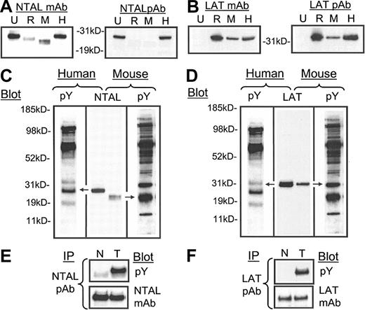 Figure 2. The expression and tyrosine phosphorylation of NTAL and LAT following FcϵRI aggregation in human mast cells. (A-B) Whole cell lysates (100 000 cell equivalents) of U937 cells (U), RBL 2H3 cells (R), mouse BMMCs (M), and HuMCs (H) were probed with anti-NTAL and anti-LAT monoclonal (m) (NAP 08) and polyclonal (p) antibodies. Comigration of (C) NTAL with pp30 in HuMCs and an equivalent tyrosine-phosphorylated protein in mouse BMMCs and (D) LAT with pp38 in HuMCs and in mouse BMMCs. HuMCs and BMMCs were triggered as described in “Materials and methods” and probed with an antiphosphotyrosine mAb (pY). Extracts as in panels A-B were probed with either an anti-NTAL pAb or anti-LAT mAb (NAP-08), and the gels were then aligned based on the migration of standard molecular-weight markers. (E-F) HuMCs were sensitized and triggered with NP-BSA (100 ng/mL) for 30 seconds (T), and then the phosphorylation was compared with nonactivated cells (N). The lysates were then probed with the indicated antibodies. The proteins in panels A-D were extracted under denaturing conditions and in panels E-F, under the conditions for immunoprecipitation as described in “Materials and methods.” IP indicates immunoprecipitation. The data are representative of n = 2 to 3.