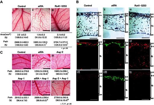 Figure 1. Impaired vascular remodeling by retinoid induced in CAM. The 4.5-day-old CAMs were implanted with a silicon ring and charged with different amounts of atRA or Ro41-5253. (A) Effect of retinoids on blood vessel formation within CAM. After 48 hours, developing new blood vessels were observed under a microscope and photographed. i, vehicle (1% ethanol); ii, 100 ng atRA; iii, 1 μg Ro41-5253. Original magnification, ×35; scale bar, 1 mm. The total area and the number of paths of blood vessels were analyzed using angiogenesis measuring software. Their relative changes are shown in parentheses. Each set of data represents the average ± SD (n = 3). Asterisks represent significant difference (P < .05) from control. (B) Structural changes induced in CAM tissues following treatment with retinoids. Vertical sections (5 μm) were stained with hematoxylin and eosin (i-iii), vertical sections (10 μm) were prepared and double-stained with a combination of either anti–Queck-1 antibody (for ECs, red) and anti-αSMA antibody (for MCs, green) (iv-vi), or anti-PCNA antibody (red) and anti-αSMA antibody (green) (vii-ix). The 6.5-day-old CAM was composed of 4 different layers, including a thin chorionic epithelium (ce), microvasculatures (mv), a thick mesenchymal layer (fb) consisting of sparsely distributed fibroblasts and a few small blood vessels (bv), and a thin allantoic epithelium (ae). Original magnification, × 200. Scale bar, 50 μm. (C) Effect of simultaneous treatment with atRA, Ang-1, and Ang-2 on blood vessel formation. The 4.5-day-old CAMs were treated with vehicle (1% ethanol; i), 100 ng atRA (ii), 300 ng human recombinant Ang-2 (iii), 300 ng human recombinant Ang-1 (iv), and combinations of atRA and Ang-1 (v), or Ang-2 and Ang-1 (vi). After 48 hours, developing new blood vessels were observed under a microscope and photographed. Original magnification, ×35; scale bar, 1 mm. The number of paths of blood vessels was analyzed as described above and presented underneath each picture with relative changes in parenthesis. Symbols *, †, and ‡ represent significant difference (P < .05) obtained by comparing to control samples (i), samples treated with atRA (ii), and samples treated with Ang-2 (iii), respectively. For panels A to C, a total of 15 eggs (n = 5 × 3 times) for each experimental group were evaluated and representative results are shown.