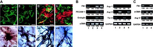 Figure 2. Changes in angiopoietins and Tie2 expressions following treatment with retinoid. (A) Effect of atRA and VEGF on differentiation of Flk1+ cells into ECs/MCs and formation of vascular tree–like structures. Flk1+ cells were cultured on collagen type 1–coated dishes for 5 days or spheroids formed by Flk1+ cells were cultured for 5 days in collagen gels in the absence and presence of atRA and VEGF. In 2D cultures, ECs and MCs were immunostained with anti–PECAM-1 antibody (red) and anti-αSMA antibody (green), respectively (i-iv). White arrowheads indicate margins of MC-EC interaction. In 3D cultures, ECs and MCs were immunostained with anti–PECAM-1 antibody (purple) and anti-αSMA antibody (brown), respectively (v-viii). Black arrowheads indicate the points showing dissociation of ECs from MCs. i, vehicle (0.5% ethanol); ii, 1 μM atRA; iii, 50 ng/mL VEGF; iv, 1 μM atRA plus 50 ng/mL VEGF. Original magnification, × 400. Scale bar, 10 μm. Representative micrographs from 3 different fields (n = 3) are presented. (B) Changes in angiopoietins and Tie2 expressions. Spheroids formed by Flk1+ cells were cultured for 5 days in collagen gels. Flk1+ cells were treated with vehicle (0.5% ethanol; lane 1), 1 μM atRA (lane 2), 50 ng/mL VEGF (lane 3), or 1 μM atRA plus 50 ng/mL VEGF (lane 4). Total RNA was isolated and mRNA levels of each of the indicated factors were assessed by RT-PCR and quantified by quantitative PCR as described in “Study design.” Representative data from 3 different experiments with similar results are presented. Relative changes were calculated after normalization to GAPDH (glyceraldehyde-3-phosphate dehydrogenase) mRNA levels and presented in parentheses under each corresponding band. (C) Effect of atRA treatment on Ang-2 mRNA levels in microvasculature layer within CAM. The 4.5-day-old CAMs were treated with vehicle (1% ethanol; lane 1), 100 ng atRA (lane 2), or 1 μg Ro41-5253 (lane 3) for 48 hours. CAM tissue was harvested from embryos, and vertical sections (15 μm) were prepared. Regions underneath the chorionic epithelium (50 pieces for one sample; each piece corresponded to about 25 μm × 500 μm) were collected using the microdissection system and total RNA was isolated. Changes in mRNA levels of the indicated factors were assessed by RT-PCR and quantitated as described in “Study design.” Relative changes were calculated after normalization to GAPDH mRNA levels and presented in parentheses under each corresponding band.