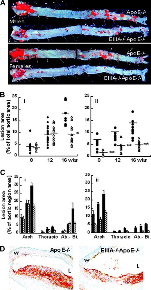 Figure 3. EIIIA–/–ApoE–/– mice are protected from atherosclerosis. (A) Male and female ApoE–/– (top) and EIIIA–/–ApoE–/– (bottom) aortae after 16 weeks on high-fat diet and stained with oil red O. (B) Quantification of total aortic lesion area over time on high-fat diet. (i) • indicates ApoE–/– males (n = 10, n = 16, n = 7 at 8, 12, or 16 weeks, respectively); ▵, EIIIA–/–ApoE–/– males (n = 7, n = 13, n = 13 at 8, 12, or 16 weeks, respectively). (ii) • indicates ApoE–/– females (n = 10, n = 9, n = 9at8, 12, or 16 weeks, respectively); ▵, EIIIA–/–ApoE–/– females (n = 9, n = 11, n = 17 at 8, 12, or 16 weeks, respectively). Total oil red O–positive area was determined by morphometry. *P < .002, **P < .001 versus ApoE–/–, using the Mann-Whitney test of ranked data. Horizontal bars represent mean values for the group. (C) Distribution of lesions in regions of the aortic tree: arch, thoracic, and abdominal to iliac bifurcation. (i) ▪ indicates ApoE–/– males; ▧, EIIIA–/–ApoE–/– males at 8, 12, or 16 weeks on high-fat diet. (ii) Females. Error bars represent SEM. (D) Cryosections of aortic arch lesions were stained with oil red O and hematoxylin. EIIIA–/–ApoE–/– lesions display patches of reduced lipid accumulation. L indicates vessel lumen; W, vessel wall.