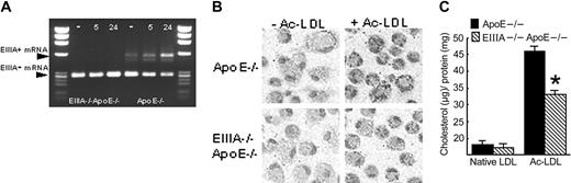 Figure 5. During in vitro foam cell formation, EIIIA mRNA is induced and EIIIA–/–ApoE–/– cells accumulate less lipid. (A) RT-PCR of foam cell mRNA at 0, 5, or 24 hours after addition of acetylated LDL. EIIIA-plus and EIIIA-minus mRNA are indicated by EIIIA+ and EIIIA– mRNA, respectively. (B) Differential interference contrast microscopy of macrophages after 72-hour incubation with or without acetylated LDL. Cells were stained with oil red O and counterstained with hematoxylin. (C) Quantification of cholesterol in cells. After 24-hour incubation with native or acetylated LDL, cells were lysed and assayed for total cholesterol and protein. Data presented reflect the means of at least 4 separate experiments. *P < .01, t test. Error bars represent SEM.