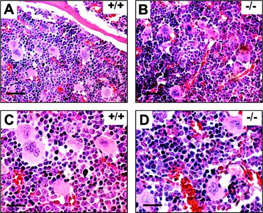 Figure 3. H & E staining of bone marrow sections. Bone marrow examinations of WT (+/+) and TXAS–/– (–/–) littermates are shown in low (A-B) and high (C-D) magnifications. Bars indicate 50 μm for panels A and B and 12.5 μm for panels C and D.