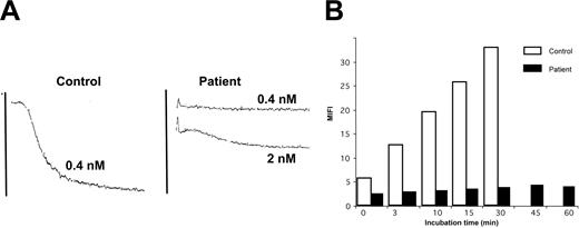 Figure 2. The patient's platelets show a much-decreased reactivity with convulxin. (A) The patient's platelets failed to react with 0.4 nM Cvx, whereas maximal aggregation was seen for control platelets. Only with much-increased amounts was a small residual aggregation seen for the patient. (B) Kinetics of the binding of FITC-Cvx to platelets as evaluated by flow cytometry. The histograms represent MFI values and show that increases were seen during a 30-minute incubation for the control, whereas for the patient the values remain close to baseline for even up to an hour.