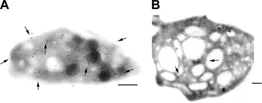 Figure 4. Immunogold labeling of GPVI on ultrathin frozen platelet sections. GPVI was detected using the MoAb F5, specific for an epitope on the extracellular domain. Bound antibody was detected using a second antibody specific for mouse IgG and adsorbed onto 10 nm gold particles. (A) For the control, gold particles were seen both on the surface and associated with internal membranes including those of granules. (B) For the patient's platelets, only an occasional labeling within the SCCS was seen. Bars = 2 μm.