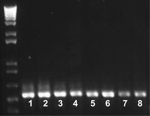 Figure 7. Messenger RNA encoding GPVI is present in the patient's platelets. Samples of mRNA isolated from the patient's platelets and those of a control donor were reverse transcribed. Two fragments of 547 bp and 540 bp, respectively, were amplified by PCR as described in “Materials and methods” and analyzed by electrophoresis in agarose gels. Lanes 1 to 4 and 5 to 8 correspond to the 8-554 and 472-1011 fragments, respectively, obtained with 2 μL (lanes 1, 3, 5, and 7) and 4 μL (lanes 2, 4, 6, and 8) samples. Control cDNA (lanes 1, 2, 5, and 6) and patient cDNA (lanes 3, 4, 7, and 8) are shown. Note the normal intensity and migration of the fragments corresponding to the patient's cDNA. Also shown are molecular size markers.