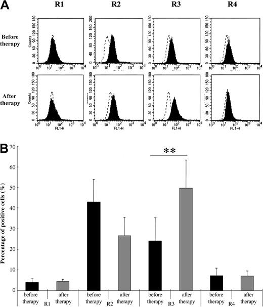 Figure 3. Comparison of TRAIL receptor expression on neutrophils of SLE patients with neutropenia before and after therapy. TRAIL receptor 3 expression levels significantly increased after treatment (**P < .05, Bonferroni/Dunn with a one-way factorial ANOVA). (A) Representative data from 8 individual experiments. Dotted line indicates IgG control intensity; solid line indicates TRAIL receptor expression intensity. (B) Data are shown with mean + standard deviations (n = 8 in each group).