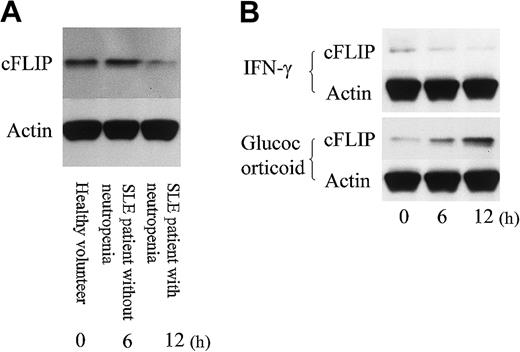 Figure 8. cFLIP expression in neutrophils. (A) Neutrophils from an SLE patient with neutropenia expressed less cFLIP than from an SLE patient without neutropenia and a healthy volunteer. Representative data from 4 individual experiments. (B) Neutrophils from an SLE patient with neutropenia were incubated with IFN-γ (50 U/mL) or glucocorticoid (500 nM) for various time durations. Glucocorticoid up-regulated cFLIP expression, while IFN-γ slightly down-regulated cFLIP expression in neutrophils. Shown are representative data from 4 individual experiments.