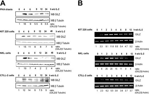 Figure 1. GILZ expression is induced by deprivation of interleukin-2 in human PHA-stimulated peripheral blood lymphocytes, human KIT 225, human NKL, and murine CTLL-2 cells. Cells were deprived of IL-2 by washing, set back in culture in the absence of IL-2, and lysed at the indicated times. (A) Western blot analysis (WB) was performed using a polyclonal anti-GILZ antibody. Membranes were stripped and reblotted with an anti–β Tubulin antibody as a loading control. GILZ expression was quantified by densitometric analysis and normalized to the densitometric value of β Tubulin (ratio GILZ/β Tubulin). (B) Total RNA was extracted and used as a template for RT-PCR using primers specific for gilz or β actin. Gilz expression was quantified by densitometric analysis and normalized to the densitometric value of β actin (ratio GILZ/β actin). w/o indicates without.