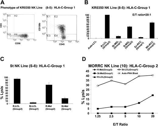 Figure 2. RCC and melanoma cells are more susceptible to the cytotoxic effects of KIR-incompatible NK clones than KIR-matched lines. NK cells were enriched and then cloned by limiting dilution from the PBMCs of cancer patient St (homozygous for HLA-C group 2) or from healthy donors homozygous for HLA-C group 1. (A) NK cell line 8-5, expanded from a C-G1 homozygous healthy donor (KR0350), killed a significantly higher percentage of C-G2 homozygous KIR-incompatible EBV-LCL, melanoma, and RCC cells than KIR-matched autologous EBV-LCL or KIR-matched allogeneic C-G1 homozygous melanoma and RCC cells (B). (C) NK line S-8, expanded from a C-G1 homozygous patient with widely metastatic melanoma (St), killed a significantly higher percentage of KIR-mismatched C-G2 homozygous EBV-LCLs and melanoma cells than autologous KIR-matched EBV-LCL and melanoma cells, in which minimal cytotoxicity was observed. Mean values +SD of 3 samples are shown. (D) MORRC NK line 10, expanded from a C-G2 homozygous healthy donor (MORRC), was cytotoxic to KIR-incompatible C-G1 homozygous but not KIR-matched C-G2 homozygous targets.