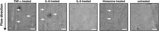 Figure 1. IL-8 and TNF-α, but not IL-6, stimulated the release of ULVWF multimers. HUVECs were stimulated with TNF-α (50 ng/mL), IL-6 (100 ng/mL), or IL-8 (100 ng/mL) for 30 minutes and then perfused with washed platelets suspended in Tyrode buffer at 2.5 dyne/cm2. The formation of the platelet-decorated ULVWF strings was detected on endothelial cells stimulated with TNF-α (A) or IL-8 (B), but not on those stimulated with IL-6 (C). Histamine-stimulated endothelial cells (D) were used as positive control. No strings formed on untreated endothelial cells (E). The figure is a representative of 6 separate experiments (bar = 100 μm).