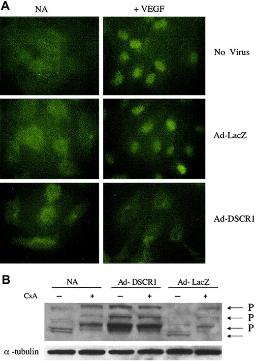 Figure 2. Cellular localization of DSCR1 and NFATc1 phosphorylation. (A) IHC analysis of HUVECs transduced with Ad-DSCR1-FLAG or control Ad-LacZ (MOI = 100) and exposed to VEGF (30 ng/mL). After 20 minutes of stimulation by VEGF, cells were fixed and cellular localization of NFATc1 was analyzed. (B) Western blot analysis of NFATc1 phosphorylation. HUVECs were transduced with the indicated adenoviral vectors (MOI = 100) or exposed to transduction media only (NA). Two days after transduction, CsA (1 μM) was added to cells and 2 hours later, cells were stimulated with PMA (200 ng/mL)/IO (5 μM) for 4 hours. Total cell extracts were subjected to Western blotting analysis using an anti-NFATc1 antibody, which recognizes NFATc1 independently of the phosphorylation status. Data shown are from 1 representative of total 3 experiments.