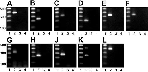 Figure 3. Agarose gel electrophoresis of PCR products. PCR products were subjected to agarose gel electrophoresis. Lane 1: 100–base pair (bp) DNA ladder. Base pairs are indicated. Lane 2: specific RT-PCR product. Lane 3: PCR analysis of RNA without RT (no-RT control). Lane 4: water control. (A) GAPDH. (B) Opioid μ1 receptor. (C) GABA B receptor. (D) 5-HT 1F receptor. (E) Adenosine A2B receptor. (F) Purinergic P2X4 receptor. (G) Voltage-gated K+ channel SRS4. (H) Voltage-gated K+ channel SRS6. (J) Neurotrophin 3. (K) Synaptobrevin 1. (L) Dystroglycan α.