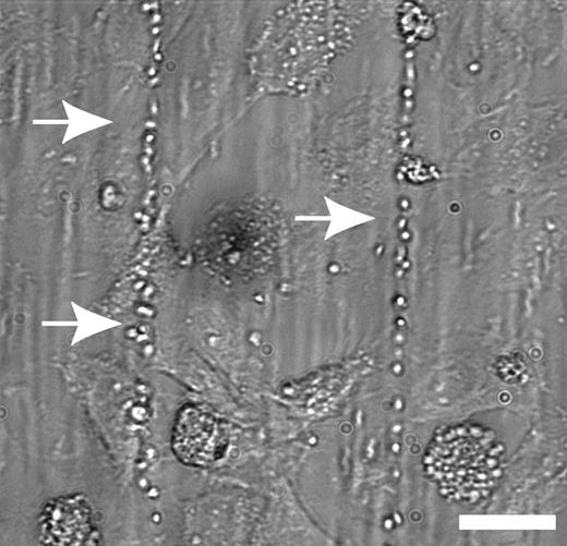 IL-8 and TNF-α, but not IL-6, stimulated the release of ULVWF multimers. See the complete figure in the article beginning on page 100.