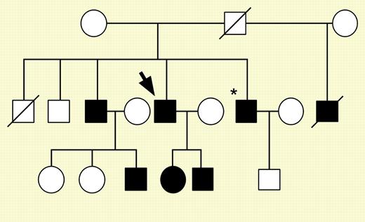 Family pedigree for patient 1 (fXI-Gly400Val). See the complete figure in the article beginning on page 128.