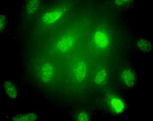 Cellular localization of DSCR1 and NFATc1 phosphorylation. See the complete figure in the article beginning on page 149.