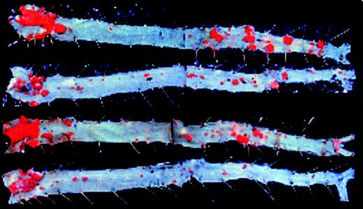 EIIIA–/–ApoE–/– mice are protected from atherosclerosis. See the complete figure in the article beginning on page 11.