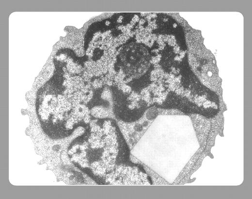 Marshall E. Kadin, Harvard Medical School