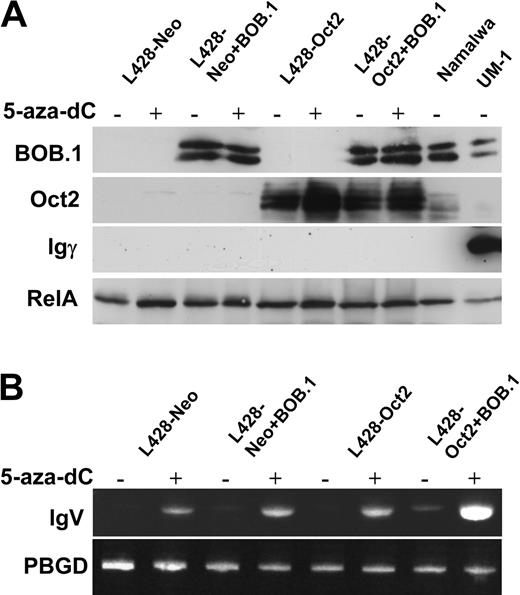 Figure 4. Oct2 and BOB.1/OBF.1 overexpression potentiates 5-aza-dC-induced Ig transcription in cHL cells. L428-neo or L428-Oct2 cells were pretreated for 24 hours with 1 μM 5-aza-dC. After an additional 24 hours in normal growth medium, cells were nucleofected with the BOB.1/OBF.1-expressing vector pCFG5-BOB.1 or by the empty vector pCFG5-IEGZ. On the next day cells were harvested and used for RNA or protein analysis as described in “Materials and methods.” (A) Expression of Oct2, BOB.1/OBF.1, and IgG gamma chains in cell lysates were assessed by Western blots. (B) RT-PCR analysis of Ig transcription was done as described in the legend for Figure 5 and in “Materials and methods.”