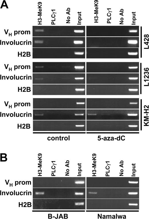 Figure 6. Chromatin in IgH gene promoters of cHL cells has a “closed” structure that can be opened by inhibition of DNA methylation. (A) L428, L1236, or KM-H2 cells were incubated for 72 hours in the presence of 500 ng of DNA methylation inhibitor 5-aza-dC (right). Local methylation at the VH promoter chromatin was analyzed by antidimethylated histone 3 lysine 9 antibodies by ChIP analysis. Signals obtained for the IgH promoter, the involucrin promoter, and the histone H2B promoter are shown. (B) Histone H3-K9 methylation was assessed by ChIP at the VH promoter regions of Ig-producing B-JAB and Namalwa cells. As controls, the histone H2B promoter and the involucrin promoter were used.