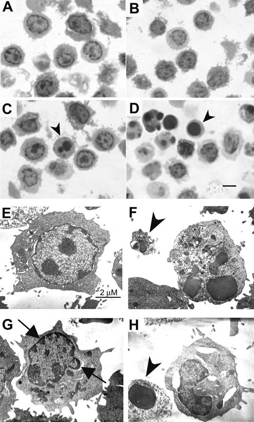 Figure 5. Ultrastructural characteristics of PSGL-1–mediated cell death. Activated T cells were incubated with TAB4 or control antibodies for 6 hours. Semithin sections (1 μm) were obtained and stained with Toluidine blue (A, R anti-H; B, HIg; C, TAB4; D, anti-CD3). Cells with dark-stained nuclei were then prepared for the electronic microscopy (E, HIg; F, anti-CD3; G-H, TAB4). Arrowhead indicates apoptotic body; arrow, peripheral condensation; scale bar, 5 μm in Figure 5D.