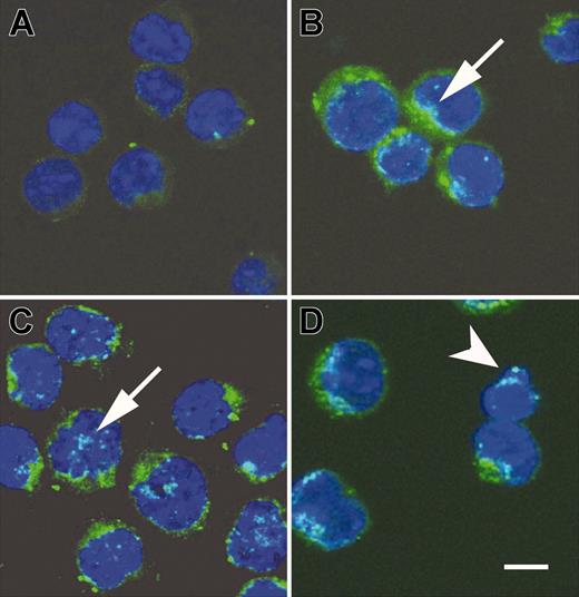 Figure 6. Cross-linking of PSGL-1 triggered release of AIF. AIF translocation during activated T-cell death induced by TAB4. Activated T cells were incubated with TAB4 for indicated time, 0 hours (A, untreated cells), 3 hours (B), 4 hours (C), and 6 hours (D). Following fixation, cells were stained with anti-AIF antibody and Hoechst 33342. Subcellular localization of AIF (green) and cell nuclei (blue) were visualized by a Leica SP2 confocal microscope. Arrowhead indicates apoptotic body; arrow, AIF translocation to nucleus; scale bar, 5 μm.