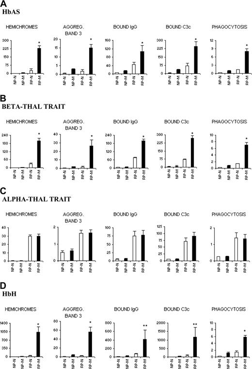 Figure 3. Membrane-bound hemichromes, autologous IgG, and complement C3c fragment; aggregated band 3 and phagocytosis in nonparasitized normal and mutant RBCs, and in ring-parasitized normal and mutant RBCs. Parameters were measured in nonparasitized normal controls (NP-N), nonparasitized mutant controls (NP-M), normal rings (RP-N), and mutant rings (RP-M) in HbAS, beta-thal trait, alpha-thal trait, and HbH RBCs. Hemichromes are expressed in nmol/mL membranes; aggregated band 3, as percentage aggregated band 3 over total band 3; membrane-bound autologous IgG and C3c, as milliabsorbance units/min/107 RBCs; and phagocytosis, as number of phagocytosed RBCs per monocyte. Note that the ordinate values may vary considerably in the different conditions. Data are mean values ± SD (vertical bars). Numbers of separate experiments each performed with a different donor were as follows: HbAS, 11; beta-thal trait, 12; alpha-thal trait, 4; and HbH, 5. Significance of differences between normal rings (RP-N) and mutant (RP-M) rings was assessed by t test for paired samples. *P < .001; **P < .01; and no asterisk, P > .05.