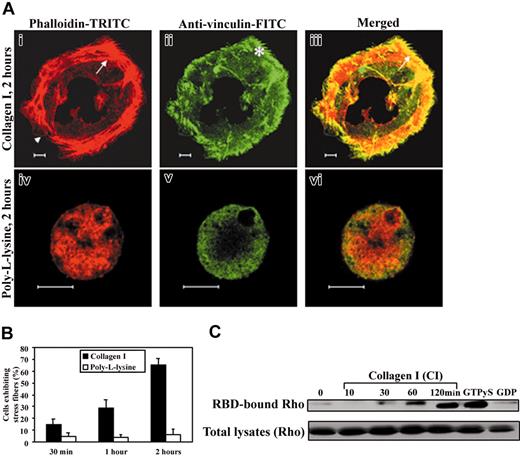 Figure 1. Fibrillar collagen I induces stress fiber and focal adhesion assembly and Rho GTP activation in primary human MKs. (A) MKs were grown for 10 days in the presence of TPO. Cells were then plated onto collagen or PLL-coated coverslips in serum-free medium and incubated for 2 hours. Adherent cells were fixed, permeabilized, and stained with rhodamine-phalloidin (i,iv) and monoclonal antivinculin FITC antibody (ii,v), as described in “Materials and methods.” Photomicrographs were taken with a Zeiss Axiovert confocal microscope (× 60). The cells shown in each panel are representative of predominant morphologies observed in 4 separate experiments. Lamellipodium and stress fibers (i,iii) are observed at the periphery of spread cells (arrowhead and arrow, respectively). Vinculin-rich focal adhesions (indicated by an asterisk) colocalize with the extremities of stress fibers (iii, arrow) in the first basal section (0.8 μm). MKs adherent to PLL substrate display mainly actin aggregates (iv,vi) and diffuse vinculin staining (v,vi) without any substantial spreading. Bar equals 10 μm. (B) The graph illustrates the mean ± SD of adherent MKs showing stress fibers on collagen I or PLL substrates for the indicated times. At least 300 cells were counted in 8 to 10 different fields in 4 separate experiments. (C) Levels of GTP-loaded Rho in primary human MKs kept in suspension or allowed to attach to collagen I-coated dishes for the indicated times. GTP-loaded form of Rho was recovered by precipitation with GST-RBD beads. Non hydrolyzable form of GTP (GTPγS) and guanosine diphosphate (GDP) were loaded as positive and negative controls, respectively. The precipitates (top panel) and total lysates (bottom panel) were subjected to SDS-PAGE and immunoblotting with polyclonal anti-Rho antibody.