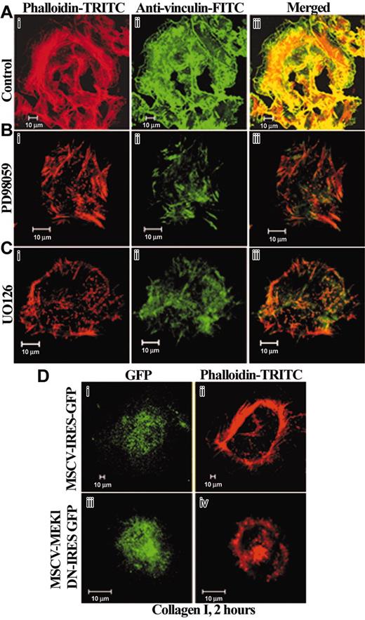 Figure 5. MAPK/Erk1/2 kinase activation is required for optimal stress fiber formation on fibrillar collagen I. Confocal sections show F-actin distribution in MKs preincubated with DMSO (A), PD98059 (B), or UO126 (C), 20 μM for 30 minutes, seeded on collagen I for 2 hours, fixed, permeabilized, and stained as indicated, with rhodamine-phalloidin and monoclonal antivinculin FITC antibody. Note the presence of punctuate F-actin and very short and disorganized peripheral actin filaments in MKs treated by PD98059 (B) or UO126 (C). Also, in contrast with the control (Aiii), actin and vinculin are not any longer colocalized in MKs treated by the inhibitors (Biii,Ciii). (D) Confocal sections of a representative image of a primary MK infected by the retroviral vector MSCV-IRES-GFP used as a control (Di) or the retrovirus containing the dominant-negative (DN) form of MEK1 (Diii) and visualized through GFP expression. MKs were plated on collagen I for 2 hours, fixed, and stained for actin with rhodamine-labeled phalloidin (Dii,iv). Note the presence of stress fibers (Dii) in the MK infected by the retroviral vector control, whereas the MK infected by the DN-MEK1 shows the presence of dense bundles of actin aggregates (Div).