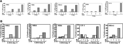 Figure 1. RA and TNF induced differentiation of RA-resistant APL cells. Differentiation of cells in response to RA and TNF for varying times. Results are representative of 3 experiments performed in triplicate. (A) Results of NBT reduction assay performed on RA-resistant APL cells treated with RA and TNF for the indicated time periods. Synergy in the number of NBT-positive cells could be observed at concentrations of 10-6 M RA and 10 ng\mL TNF. (B) Cytofluorimetric analysis of surface marker expression. Percentage of cells expressing the monocyte-specific CD14 and myeloid-specific CD11b cell surface markers of differentiation was determined by using monoclonal fluorescein isothiocyanate (FITC; CD14) and phycoerythrin (PE; CD11b) labeled antibodies. Results are representative of 1 experiment of 3 performed in triplicate.