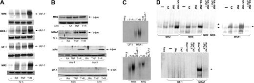 Figure 3. Regulation of transcription factors involved in monocytic differentiation in RA-resistant APL cells. (A) Northern blotting of IRF-7 mRNA levels in RA-resistant APL cells. IRF-7 levels were seen to increase dramatically in cells treated with RA and TNF but not in response to either agent alone. The top panel for each cell line shows IRF-7 levels, and the bottom panel represents actin mRNA levels. (B) Western blotting showing c-jun expression in RA-resistant APL cells. Results show a positive correlation between c-jun expression and cells undergoing monocytic maturation. (C) Electrophoretic mobility shift assay (EMSA) analyses of AP-1 binding in RA-resistant APL cells in response to TNF and RA. Binding to an AP-1 site was seen to increase in response to these 2 agents in all cells tested except for UF-1. (D) EMSA analysis of PU.1 DNA binding in RA-resistant APL cells in response to RA and TNF at 72 hours after treatment. Binding data demonstrate an increased binding affinity of PU.1 in response to TNF and RA in cells undergoing monocytic differentiation. The presence of PU.1 in binding complexes was confirmed in reactions using anti-PU.1 antibodies. Complexes specifically inhibited by the PU.1 antibody are denoted with an arrow. Binding reactions were performed with a consensus PU.1 oligonucleotide and 12 μg nuclear extracts.