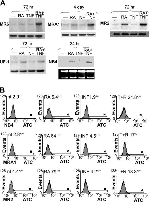 Figure 4. m-CSF-1R expression in RA-resistant APL cells. (A) Northern blotting was used to examine m-CSF-1R levels in response to RA and TNF. m-CSF-1R levels were observed to increase in response to RA in only UF-1 and MR2 cells within 72 hours of treatment. The combination of TNF and RA induced a large increase in m-CSF-1R levels in all RA-resistant cells undergoing monocytic differentiation but not in UF-1 cells. (B) FACS analysis showing heightened cell surface expression of m-CSF-1R in response to 3-day treatments with TNF and RA. Percentages indicate positive staining.