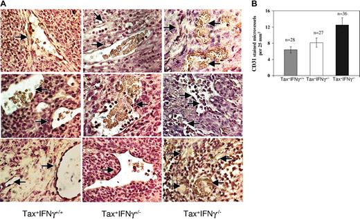 Figure 4. Angiogenesis in WT and IFN-γ knockout tumors. (A) CD31 (PECAM-1) staining for qualitative analysis of microvessel density Paraffin-embedded tissue sections were subjected to deparaffinization, rehydration, and antigen unmasking as described in “Materials and methods.” At least 4 tumor specimens were stained for each genotype as follows: each slide was incubated with 5 μg/mL CD31 antibody diluted in 1% normal goat serum for 1 hour at room temperature, and the bound antibody was stained by means of the ABC immunohistochemistry kit with the use of streptavidin-HRP. The slides were counterstained in Harris hematoxylin and mounted. (B) Quantitation of angiogenesis in WT and IFN-γ knockout tumors. The tissues were observed under a bright-field microscope for quantitative evaluation of positively stained blood vessels or angiogenic areas at 200 × magnification. The numbers of fields quantitated are denoted as n values. The statistical significance for analysis was established with a paired t test as follows: Tax+IFN-γ+/+ versus Tax+IFN-γ+/- (P ≤ .11); Tax+IFN-γ+/- versus Tax+IFN-γ-/- (P ≤ .03); and Tax+IFN-γ+/+ versus Tax+IFN-γ-/- (P ≤ .002). Error bars correspond to SEM.