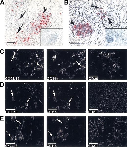 Figure 1. CXCL13-expressing cells in human lymphoid neogenesis and normal secondary lymphoid tissue are CD11c+. (A-B) In situ hybridization for CXCL13 mRNA (red) in inflammatory lesions: (A) RA and (B) UC (insets, same fields with sense controls). Cells with CXCL13 mRNA are abundantly present in irregular lymphoid aggregates (arrowheads) and also scattered in areas with diffuse mononuclear cell infiltration (arrows). (C-E) Single exposures of multicolor immunofluorescence staining for CXCL13, CD11c, and CD20 (see keys) in inflammatory lesion or germinal centers of normal lymphoid tissue. CXCL13-expressing scattered CD11c+ cells (arrows) occur in small collections of CD20+ B cells in RA (C) lesion, and in germinal center of tonsil (D) or Peyer patch (E). Note that in the RA lesion the cells show different CXCL13 expression levels consistent with ongoing up-regulation, whereas in the germinal centers this level appears similar among the positive cells. Bars represent 200 μm (A-B) and 50 μm (C-E).